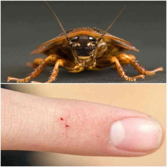 Могут ли тараканы кусать человека