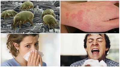 Симптомы аллергии, вызванной пылевым клещом