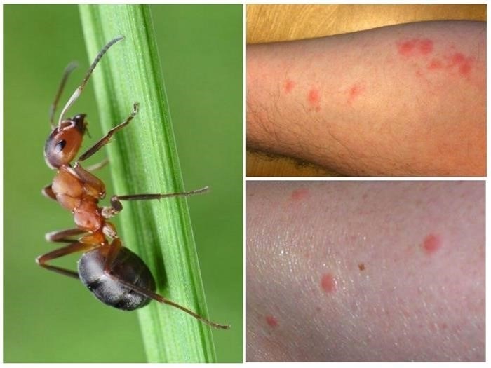 Как обезопасить себя от укусов муравьев