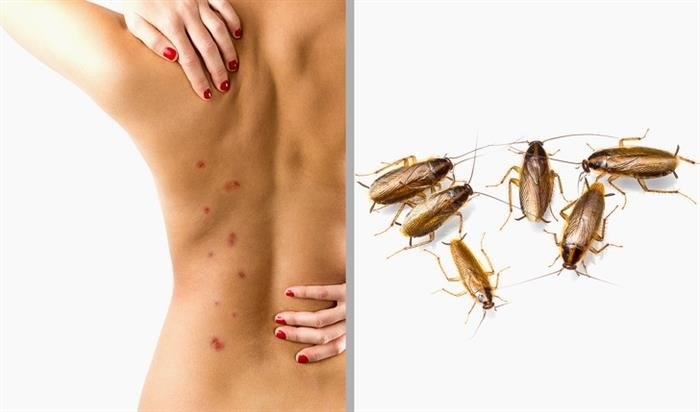 Что может привести к тому, что тараканы начинают кусать людей?
