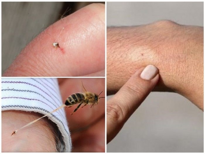 Последствия укуса мухи для организма