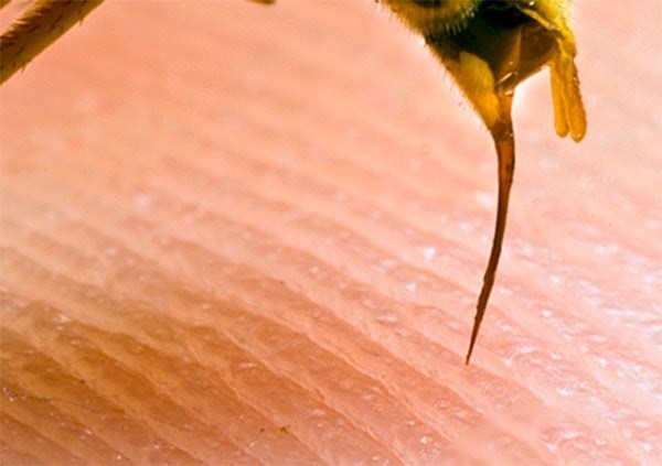 Кто больнее жалит: оса или пчела?