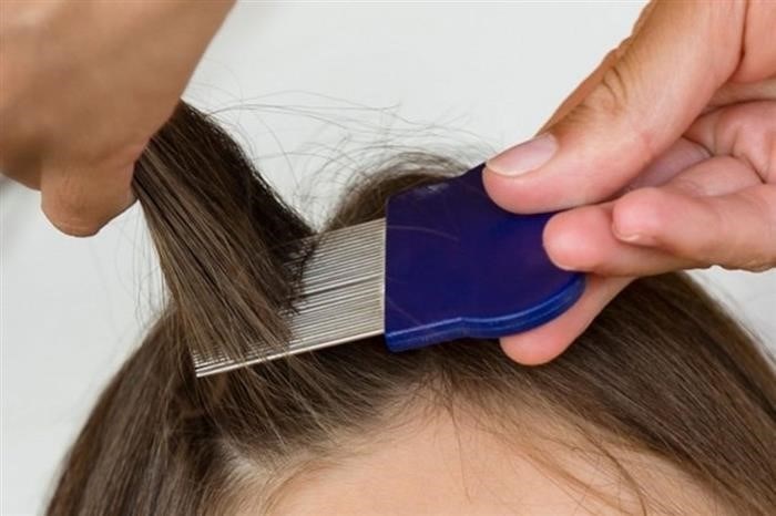 Как часто нужно проводить процедуру удаления гнид с длинных волос?