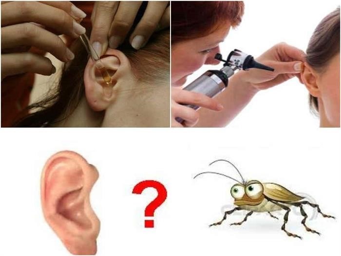 Как извлечь мертвого таракана из уха