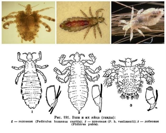 Какие условия требуются для размножения вшей?